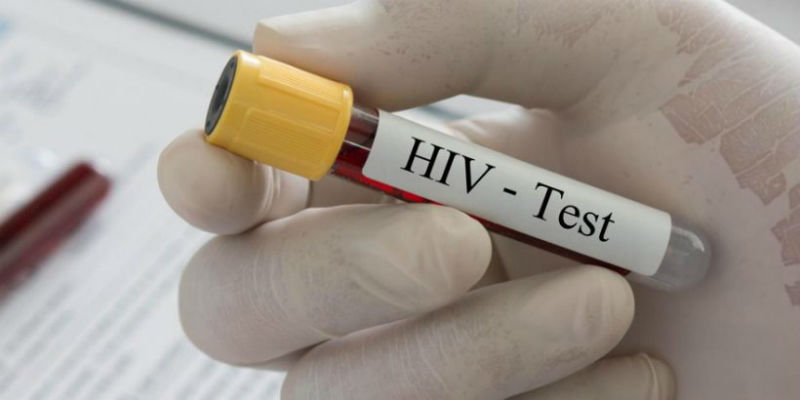 Macedonia registers 39 HIV cases in 2017